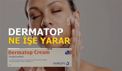 Dermatop krem ne işe yarar?